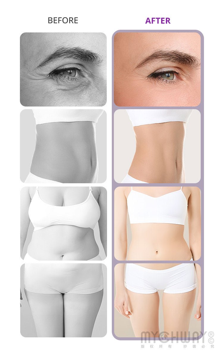 Aristorm 10-IN-1 40K Cavitation Lipo Laser Body Fat Slimming Skin Care Machine - myChway UK