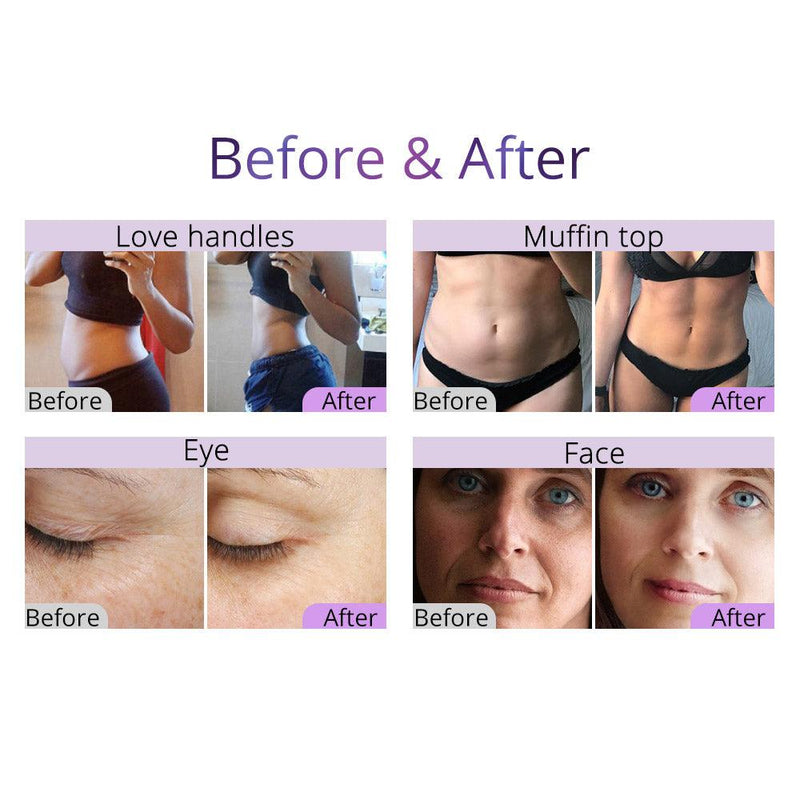 Aristorm 40k Cavitation 2.5 Slim Body Contouring Machine - myChway UK