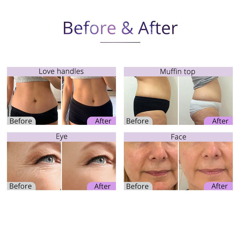 Aristorm 6 In 1 Lipo 40K Cavitation 2.5 RF Vacuum Slimming Beauty Machine For Body Sculpting Skin Tightening - myChway UK