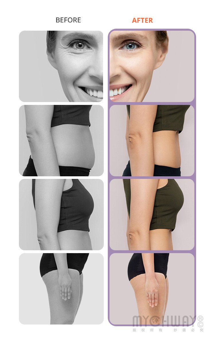 Aristorm S Shape Machine 30K Ultrasound Body Shape Facial Lifting Spa & Home Use - myChway UK