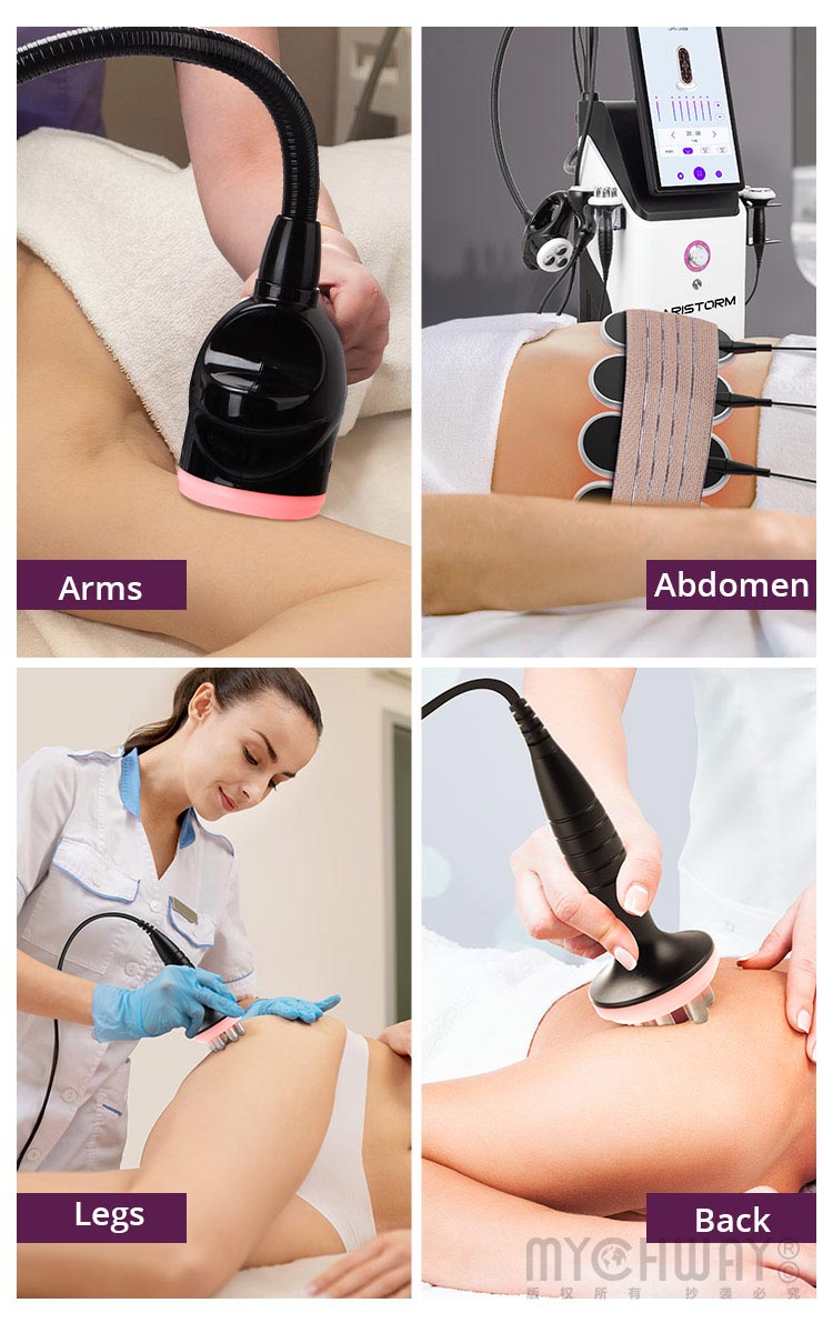 Aristorm S Shape Machine 3D 30K RF Vacuum EMS 5in1 Mutifunction Body Sculpting - myChway UK