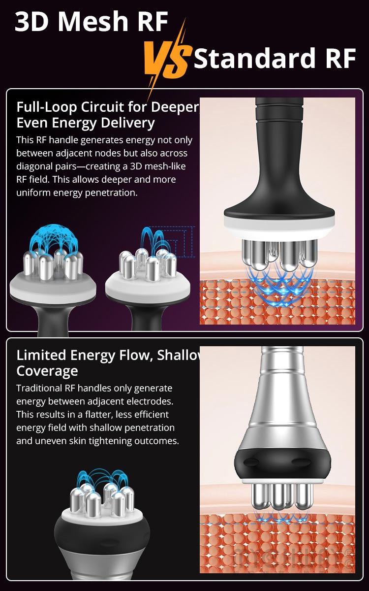 Aristorm S Shape Machine 3D 30K RF Vacuum EMS 5in1 Mutifunction Body Sculpting - myChway UK