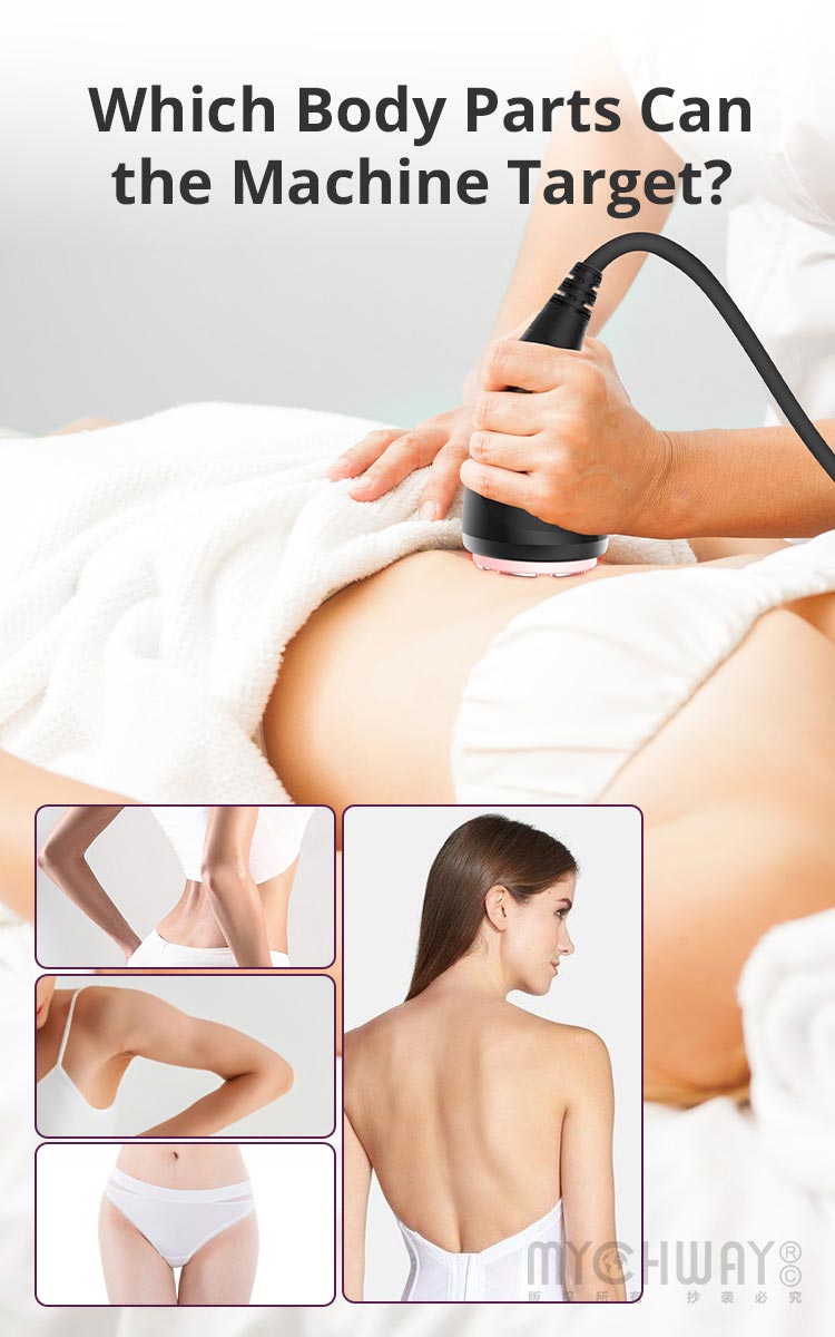 Aristorm S Shape Machine 3D 30K RF Vacuum EMS 5in1 Mutifunction Body Sculpting - myChway UK