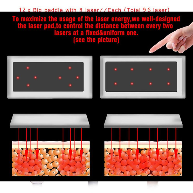 Best 16 Pads LED Slimming Photon Powerhouse - myChway UK