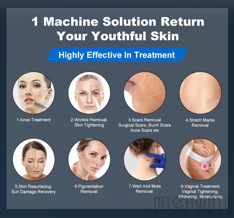 Co2 Fractional Laser Machine For Acne Scar Marks Removal Vaginal Tightening - myChway UK