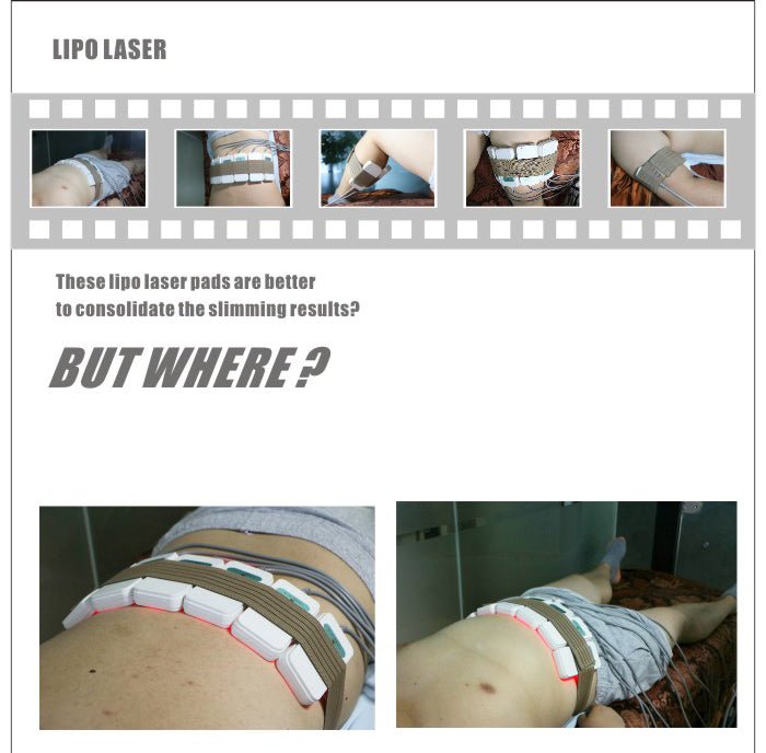 Dual Wavelength 650nm & 980nm Diode Lipo Lase Slimming Machine 6big 2small Pad - myChway UK