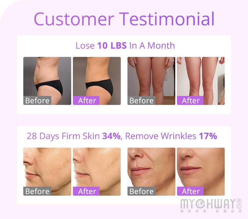 Face Lift 30 khz Cavitation Machine - myChway UK