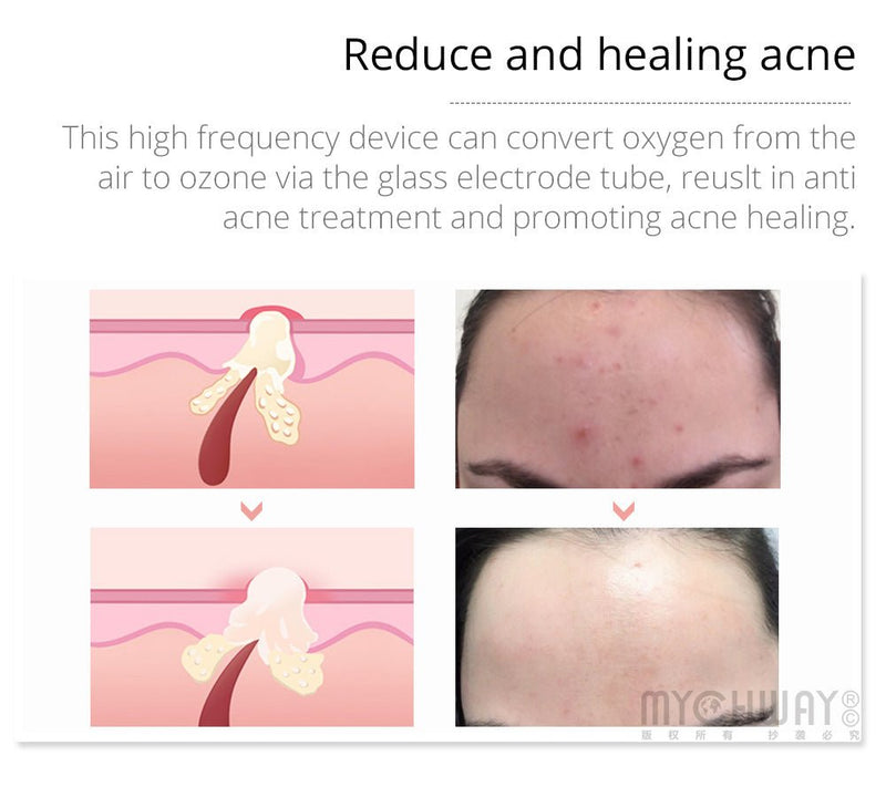 High Frequency Facial Machine Skin Spot Remover Portable Beauty Infrared Device - myChway UK