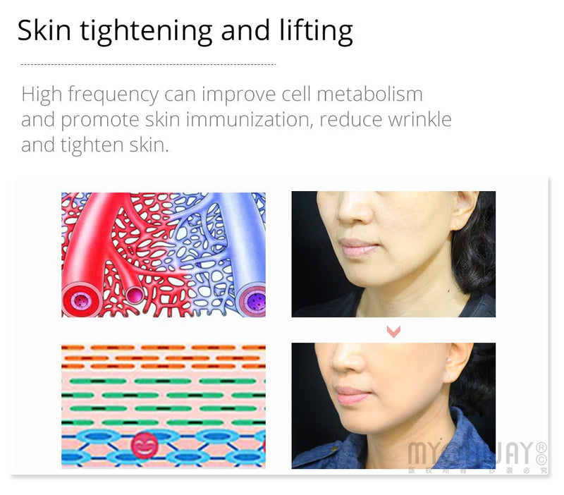 High Frequency Facial Machine Skin Spot Remover Portable Beauty Infrared Device - myChway UK
