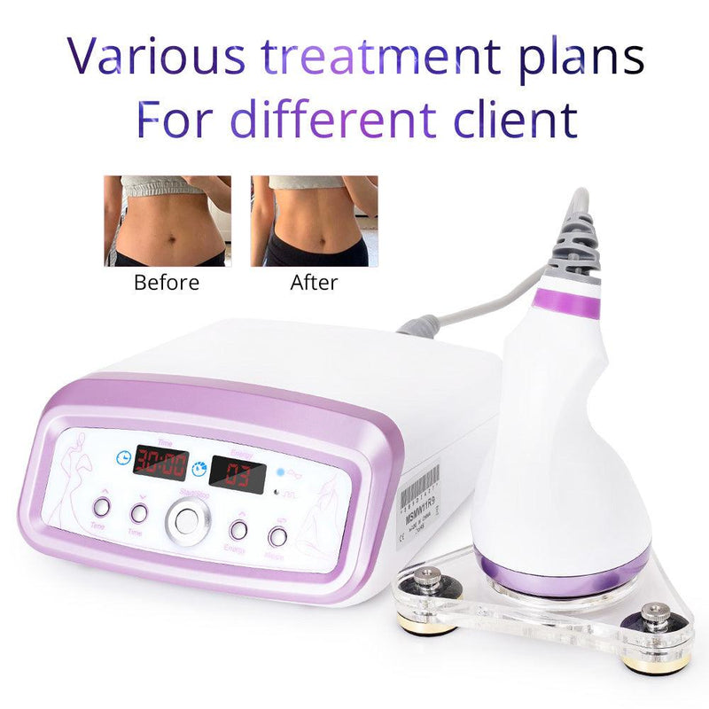 Home Use 2.5 Body Endermologie Machine - myChway UK