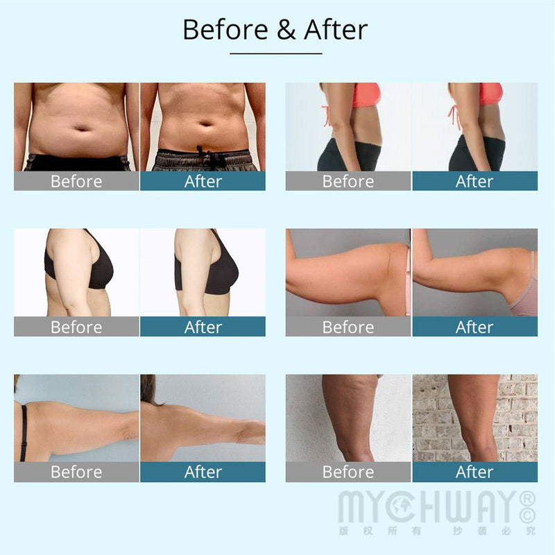 Hot Seller Vacuum Ultrasonic Cavitation 9 IN 1 Radio Frequency Machine For Body Slimming Skin Care - myChway UK