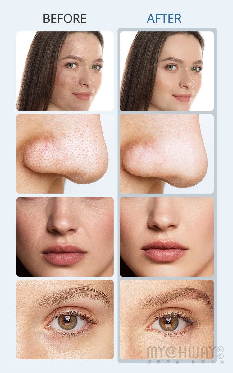 Hydrofacial Treatment Machine Home and Beauty Salons Use - myChway UK