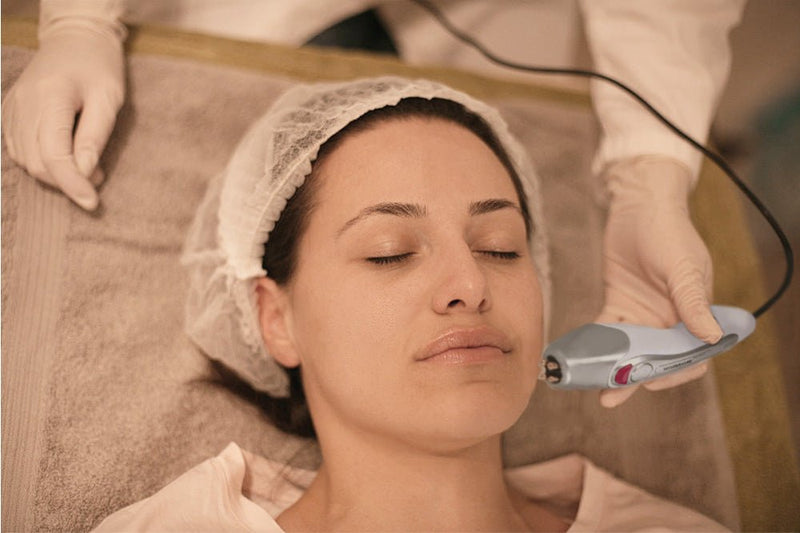 Intelligent Fractional R - F Radio Frequency Dot Matrix Lattic Skin Lifting Machine for Spa & Home Use - myChway UK