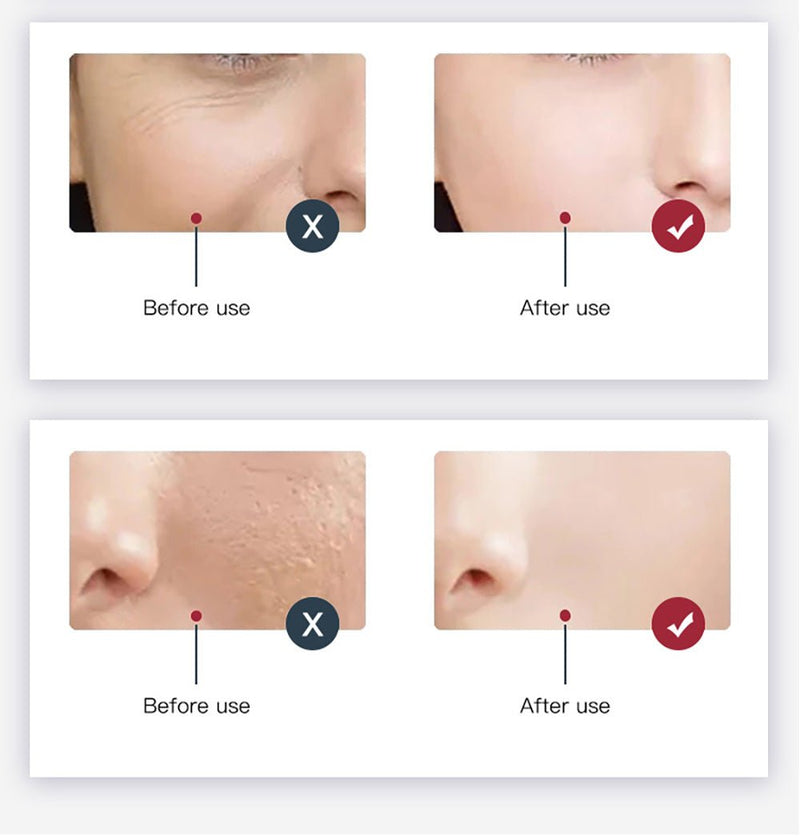 Led Light Therapy Devices PDT LED Light Therapy Facial Machine - myChway UK