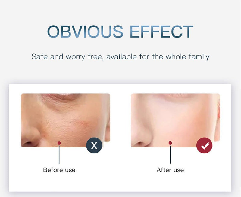 Led Light Therapy Devices PDT LED Light Therapy Facial Machine - myChway UK