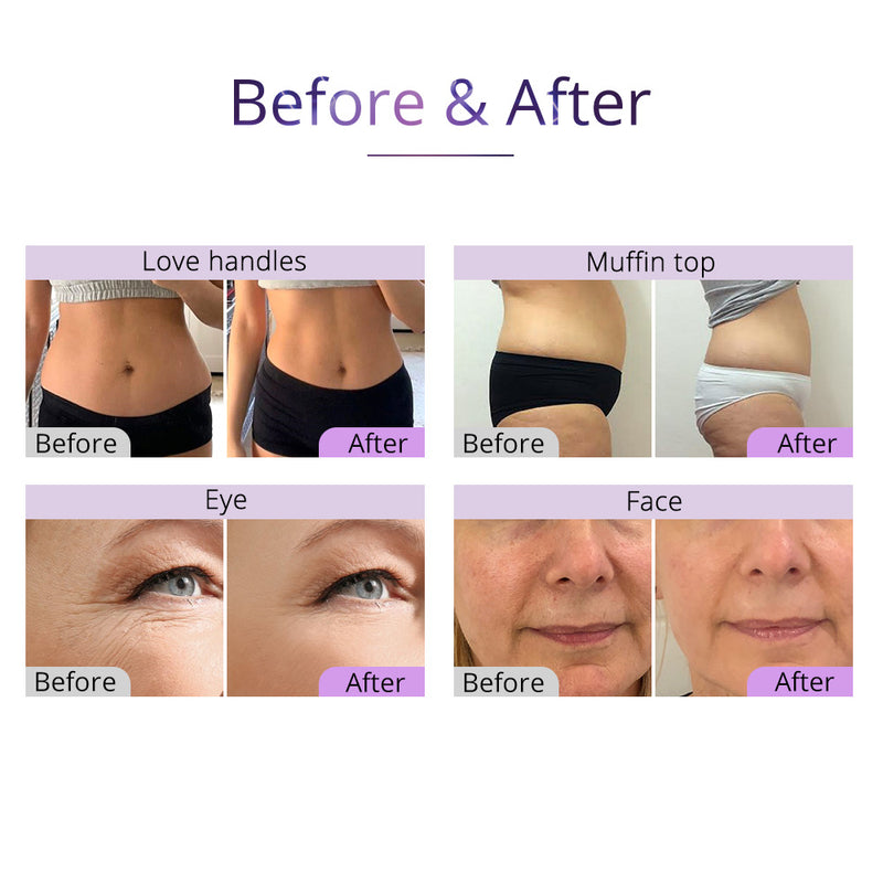 Aristorm 6 In 1 Lipo 40K Cavitation 2.5 RF Vacuum Slimming Beauty Machine For Body Sculpting Skin Tightening