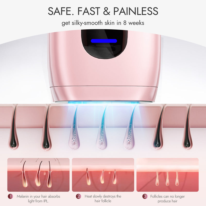 NAISIGOO Pink IPL Hair Removal Device - myChway UK
