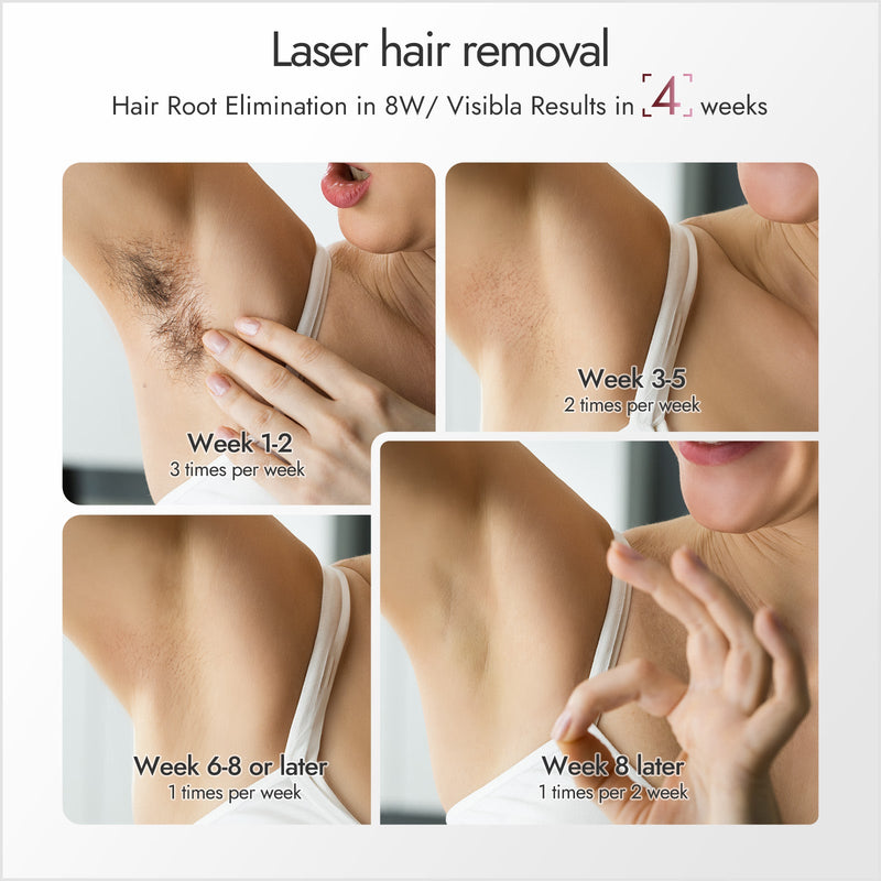 NAISIGOO Pink IPL Hair Removal Device - myChway UK