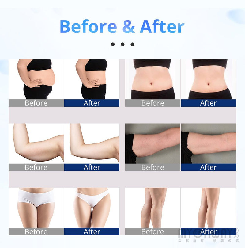 New 635NM 650NM LED Laser 160MW Slimming Machine 8 Big 4 Small Pads Machine - myChway UK