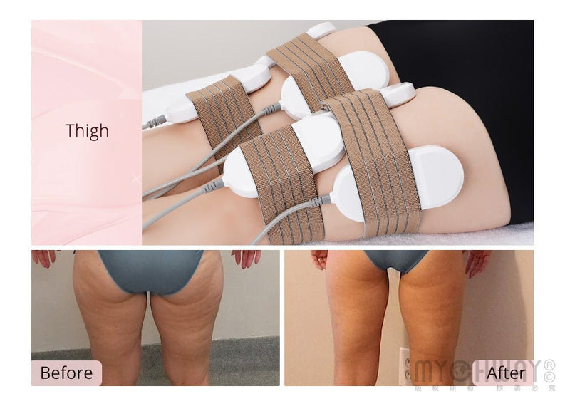 New 635NM 650NM LED Laser 160MW Slimming Machine 8 Big 4 Small Pads Machine - myChway UK