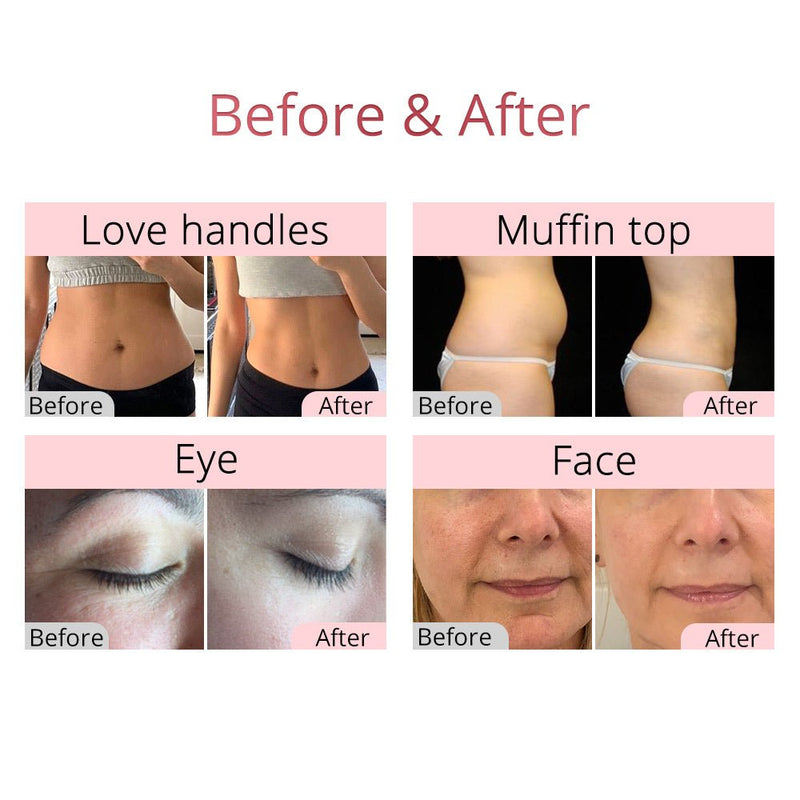 New Arrival 40k Cavitation Rf Radio Frequency Skin Tightening Machine for Body Sculpting Skin Care - myChway UK