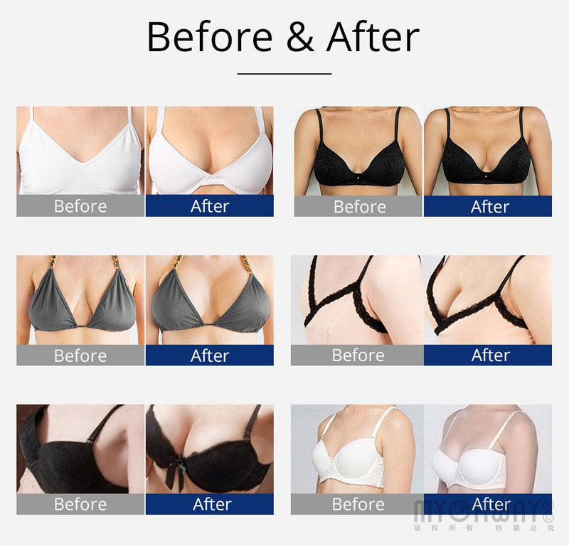 New Arrival Vacuum Massage Slimming Machine - myChway UK