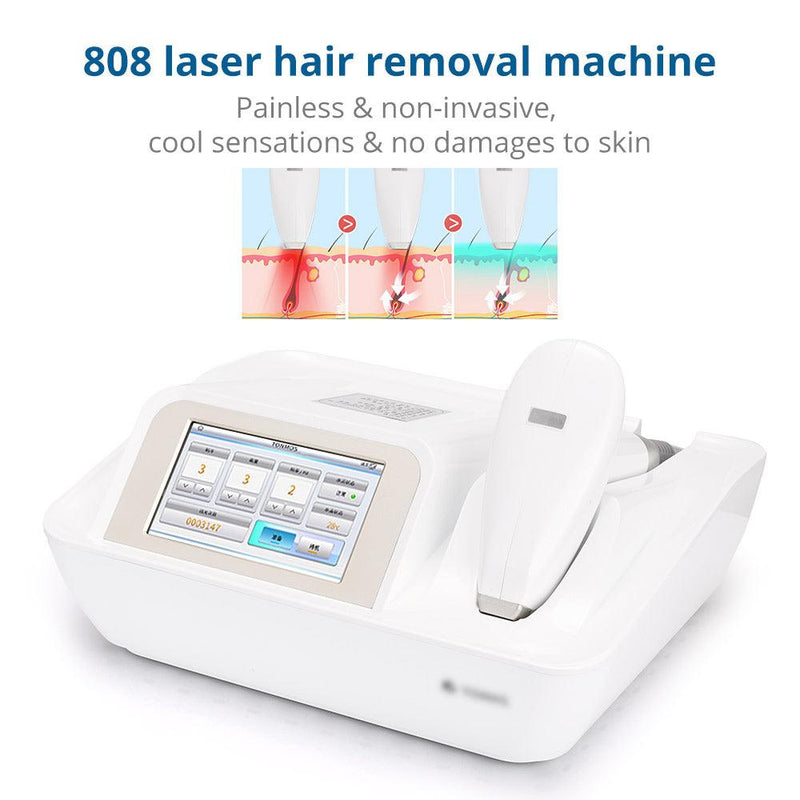 Portable 808nm Laser Machine Hair Removal Home Use - myChway UK