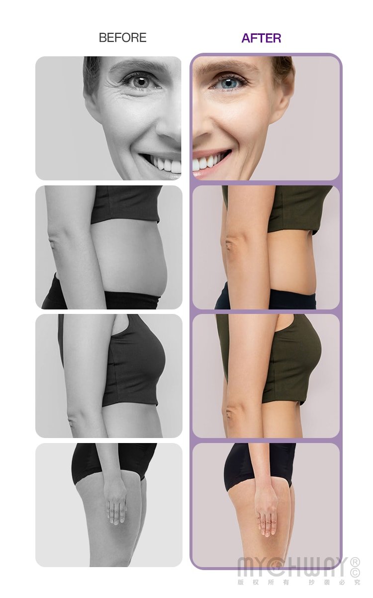 Professional 9 - in - 1 40k Lipo Cavitation Body Sculpting & Facial Care Machine - myChway UK