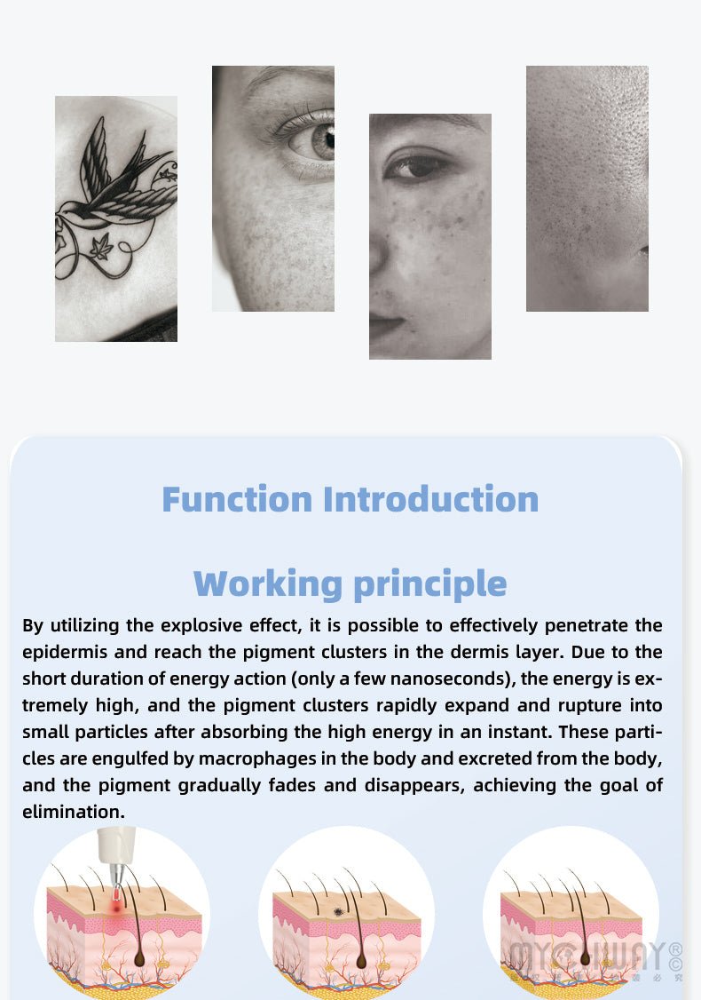 Professional Q Switch ND YAG LASER Tattoo Removal Eyebrow Callus Removal Machine - myChway UK