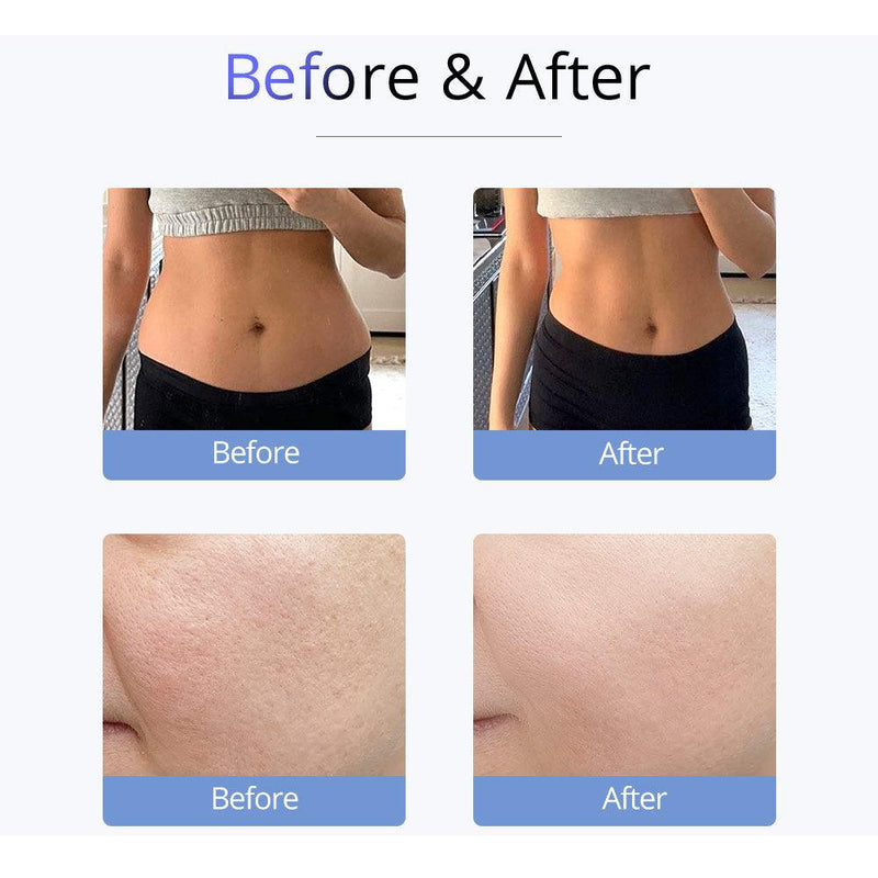 S Shape 30K Cavitation 2.5 Grease Reduce R - F Face Lift EL - myChway UK