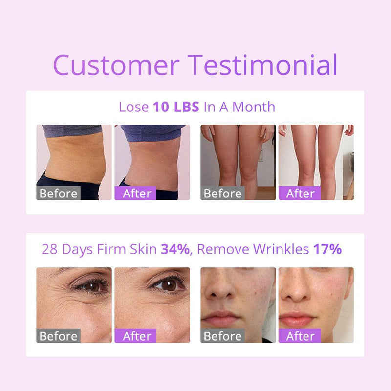 S Shape Cavitation 2.5 Vacuum R - F Fat Reduce - myChway UK