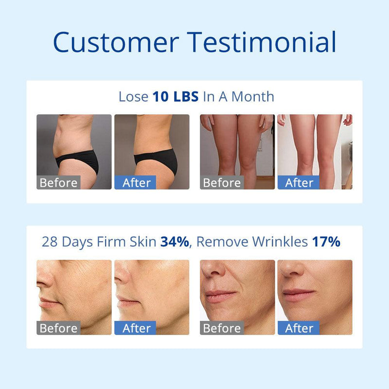 S Shape Multi - Functional Vacuum Body Face Care LED Cavitation Machine - myChway UK