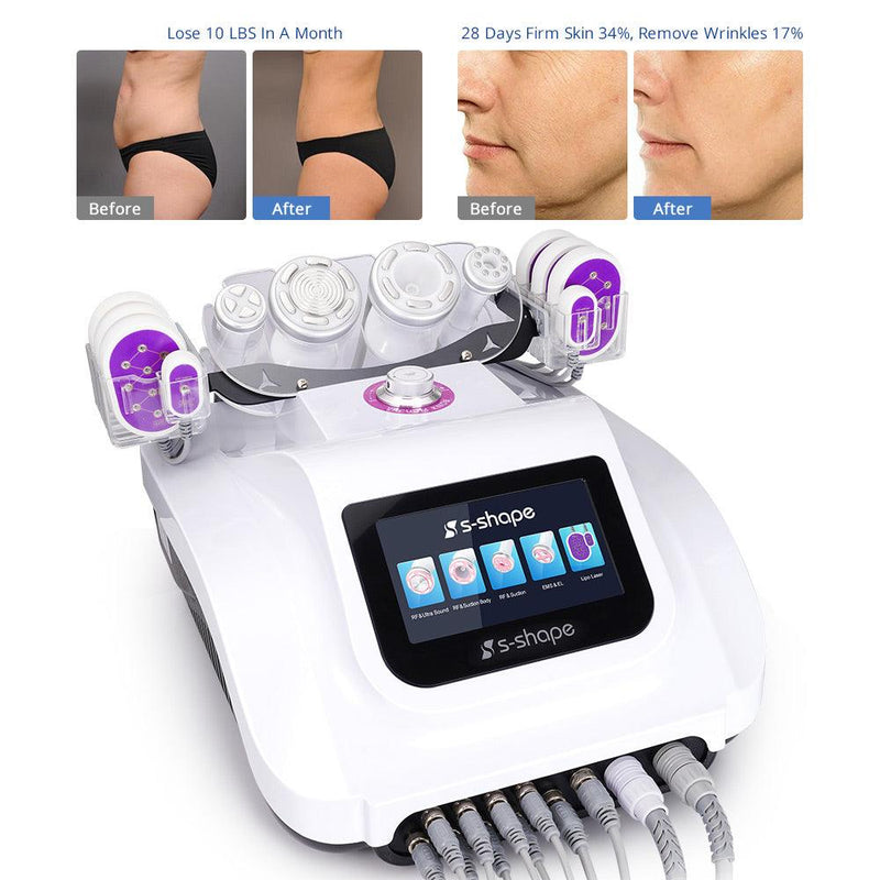 S Shape Multi - Functional Vacuum Body Face Care LED Cavitation Machine - myChway UK