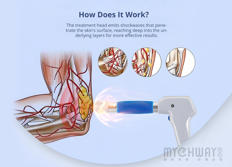 Shockwave Therapy Machine With 5 Working Head For Body Pain Relief - myChway UK