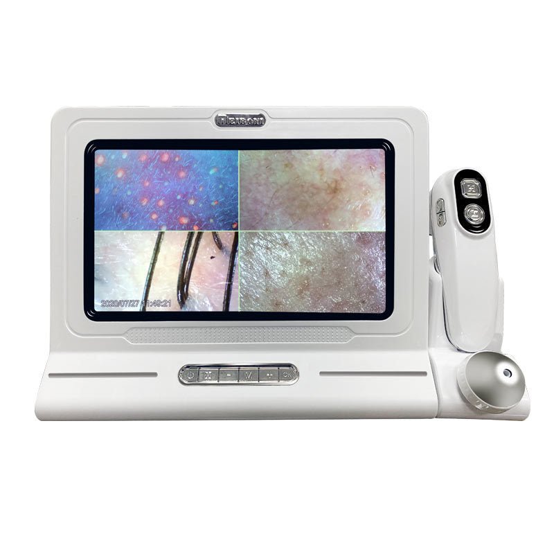 Skin Diagnosis Hair Analyzer 11 - inch Skin Scalp Detector W/ 50X 200X Dual Heads - myChway UK