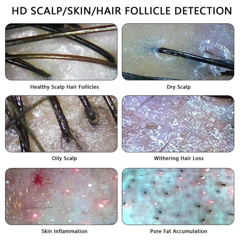Skin Diagnosis Hair Analyzer 11 - inch Skin Scalp Detector W/ 50X 200X Dual Heads - myChway UK