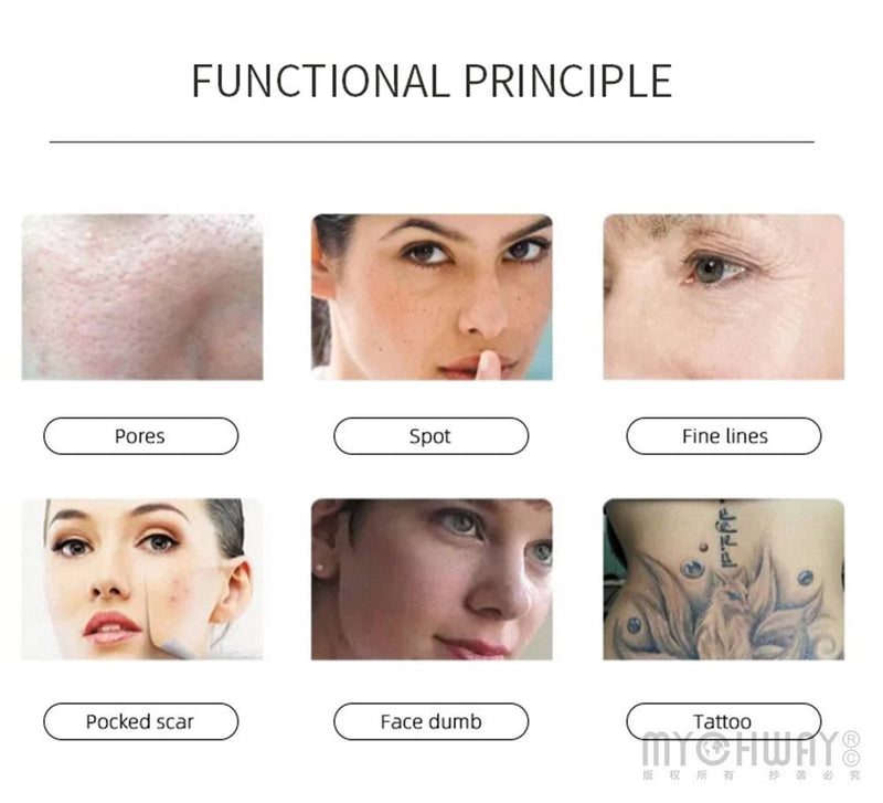 Tattoo Removal 1064nm 532nm 755nm 1320nm Skin Whitening Picosecond Laser Machine - myChway UK