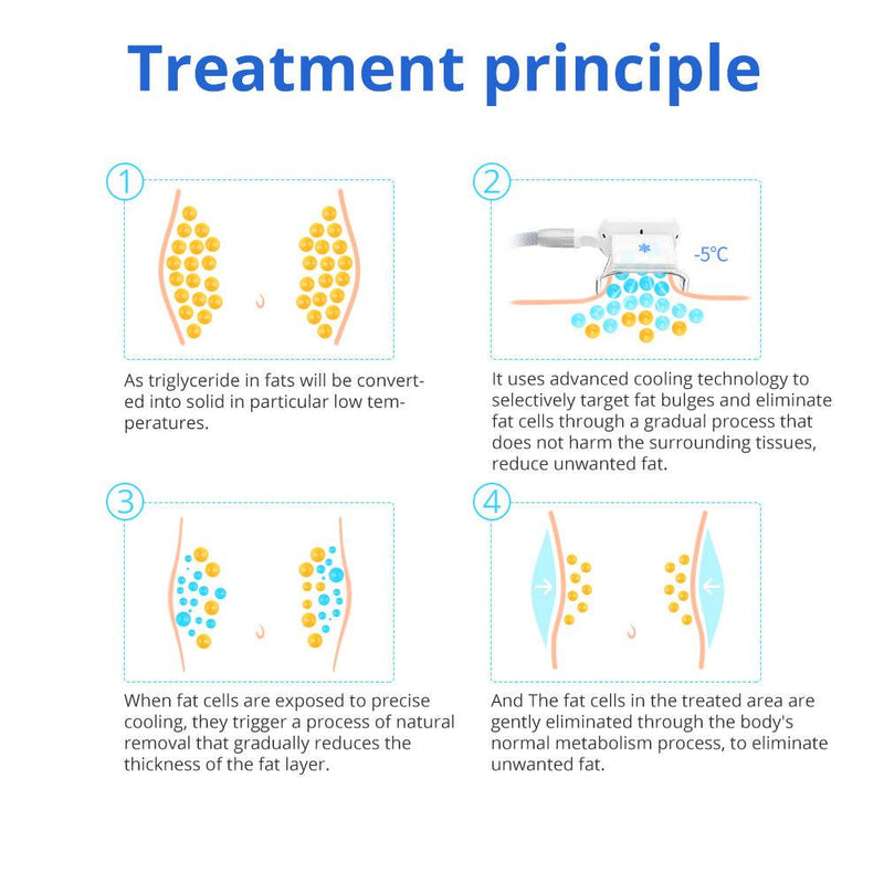 Two Handles Cryolipo Machine - myChway UK