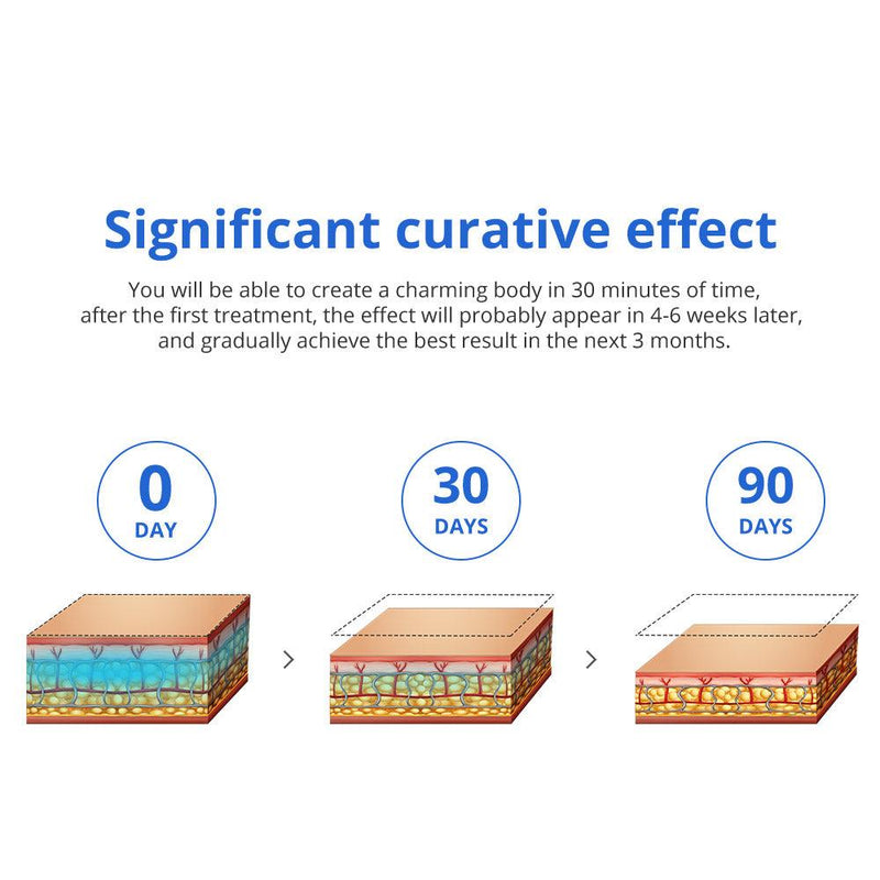 Two Handles Cryolipo Machine - myChway UK