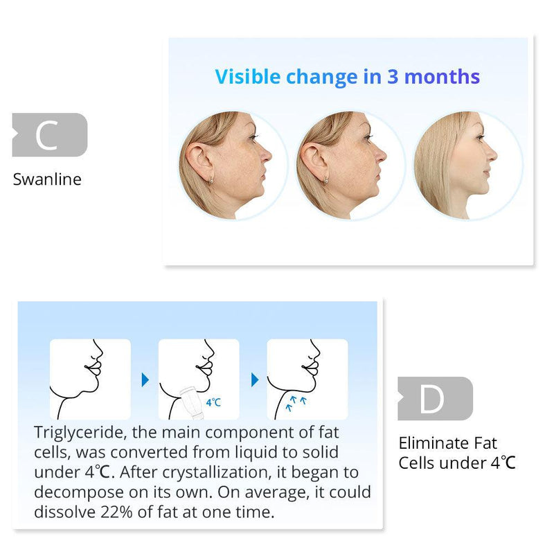 U Shape Double Chin Cryo Machine - myChway UK