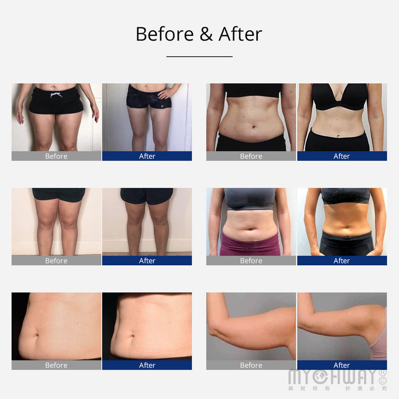 6-In-1 360° Rotary RF Ultrasonic Cavitation Vacuum Weight Loss Slimming Machine