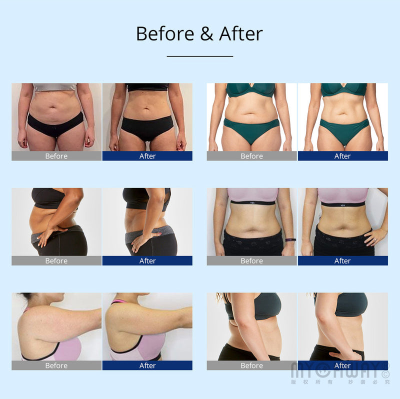 3D Rotating RF 40K Cavitation Vacuum Cold Photon Microcurrent Slimming Machine