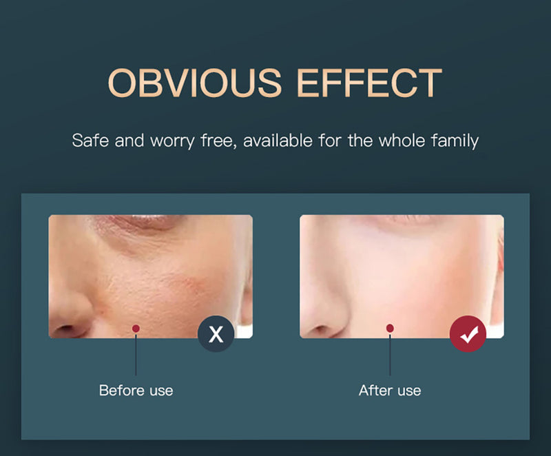 PDT Skin Care Facial Body Led Light Therapy Rejuvenation Lamp