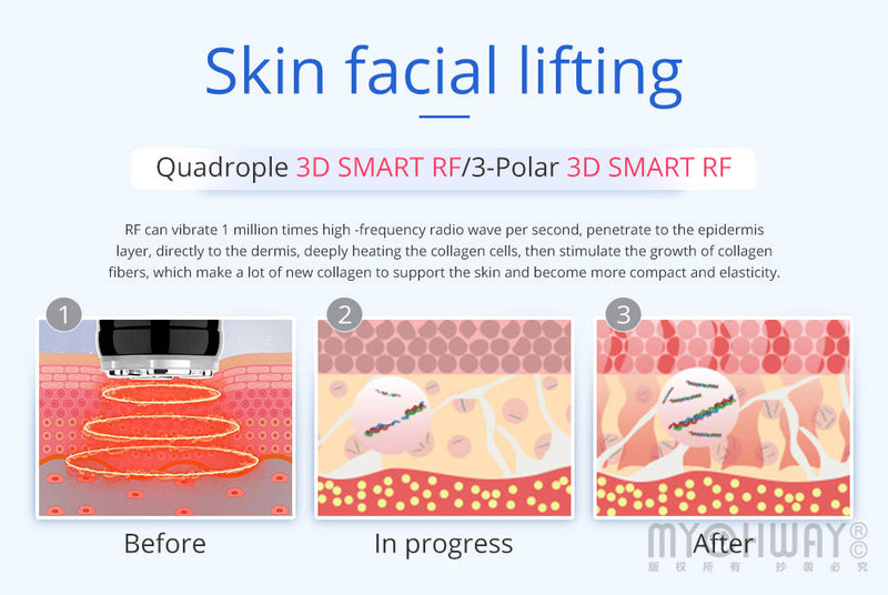 8 IN 1 Ultrasonic Cavitation Vacuum RF Microcurrent Body Slimming Laser Machine