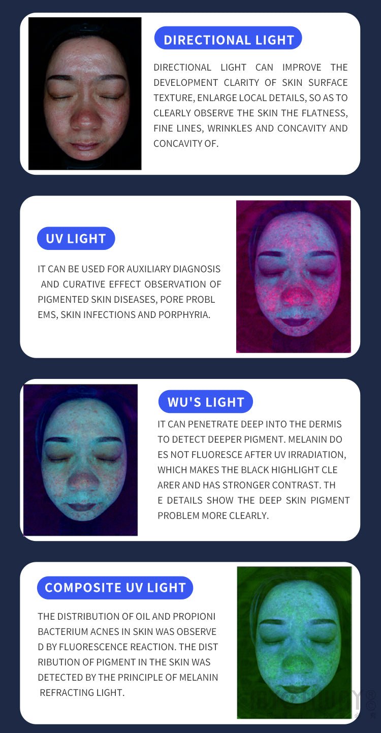 X5 Pro AI Skin Image Analyzer Facial Scalp Detection Health Management Machine - myChway UK