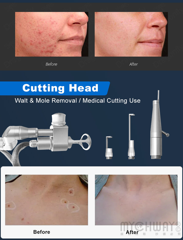 Co2 Fractional Laser Machine For Acne Scar Marks Removal Vaginal Tightening
