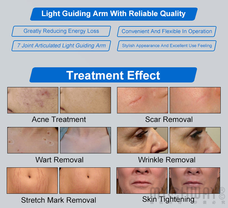 Co2 Fractional Laser Machine For Acne Scar Marks Removal Vaginal Tightening